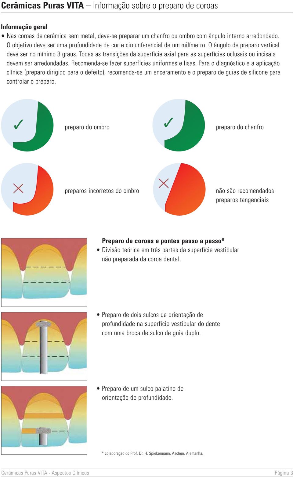 Todas as transições da superfície axial para as superfícies oclusais ou incisais devem ser arredondadas. Recomenda-se fazer superfícies uniformes e lisas.