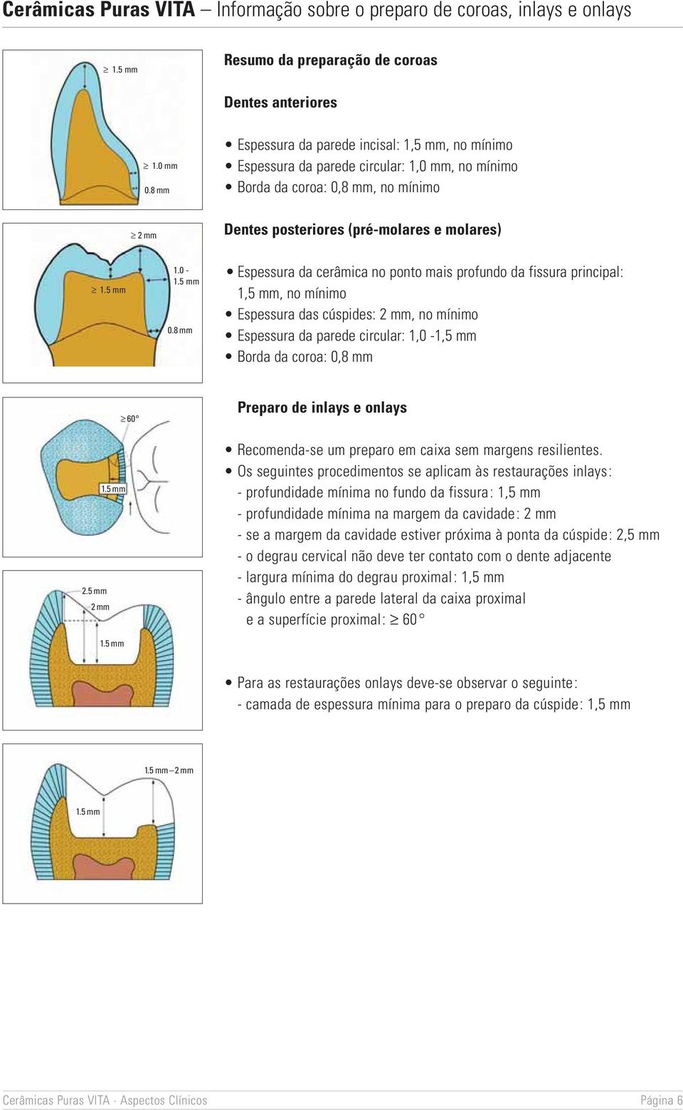 8 mm Dentes posteriores (pré-molares e molares) Espessura da cerâmica no ponto mais profundo da fissura principal: 1,5 mm, no mínimo Espessura das cúspides: 2 mm, no mínimo Espessura da parede