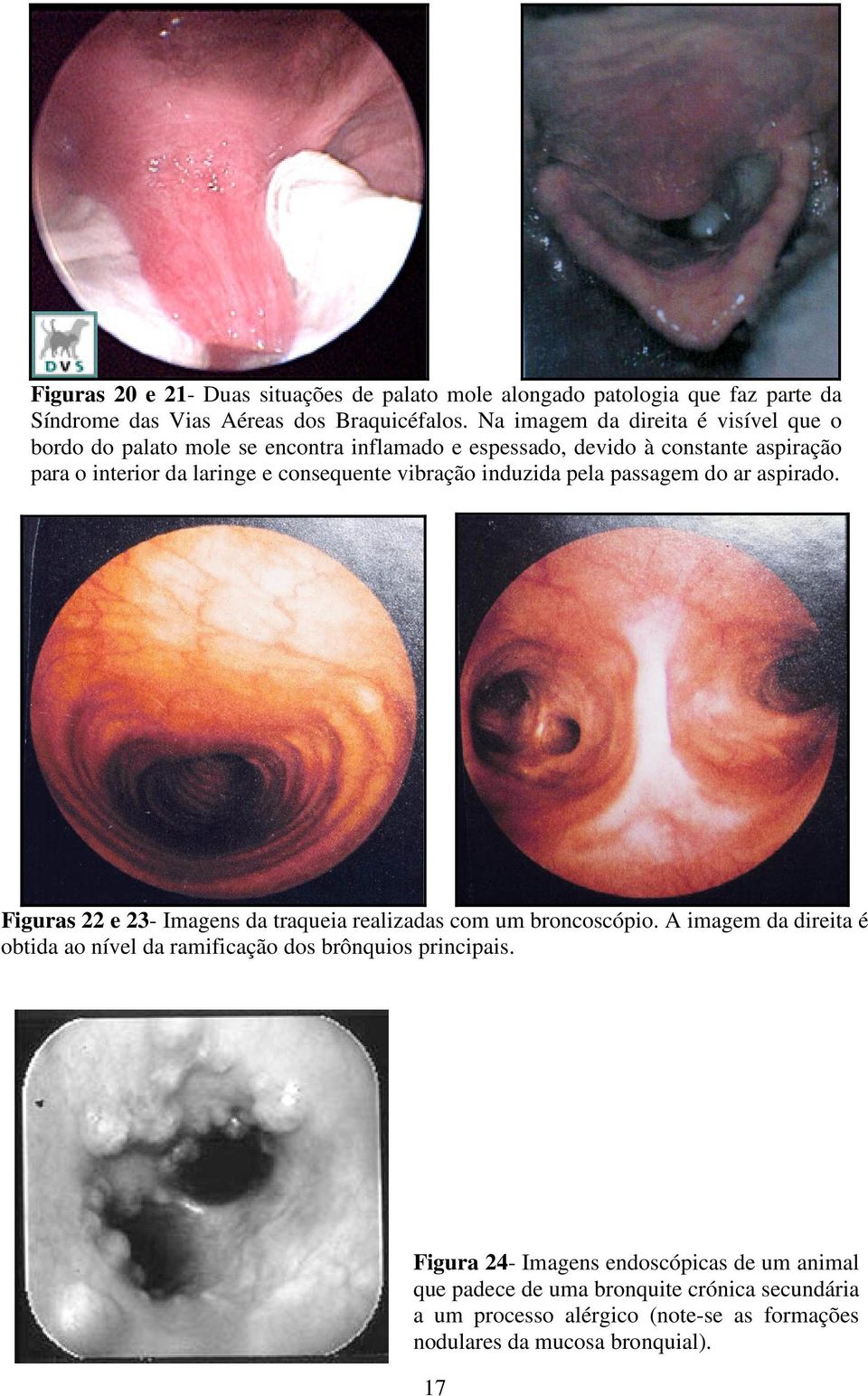 vibração induzida pela passagem do ar aspirado. Figuras 22 e 23- Imagens da traqueia realizadas com um broncoscópio.