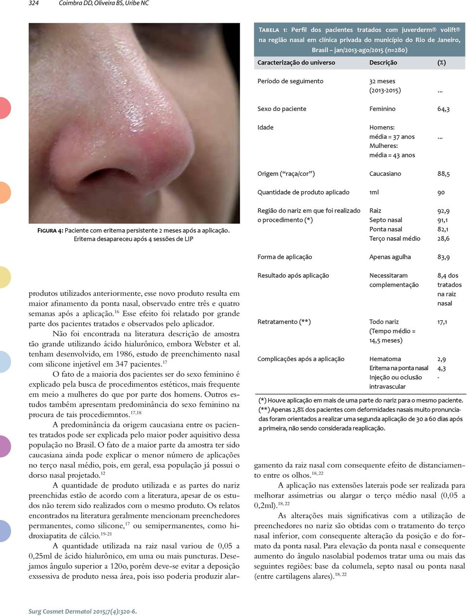 .. Mulheres: média = 43 anos Origem ( raça/cor ) Caucasiano 88,5 Quantidade de produto aplicado 1ml 90 Figura 4: Paciente com eritema persistente 2 meses após a aplicação.