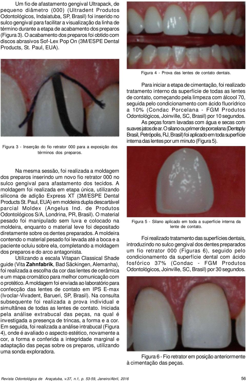 Figura 4 - Prova das lentes de contato dentais. Figura 3 - Inserção do fio retrator 000 para a exposição dos términos dos preparos.