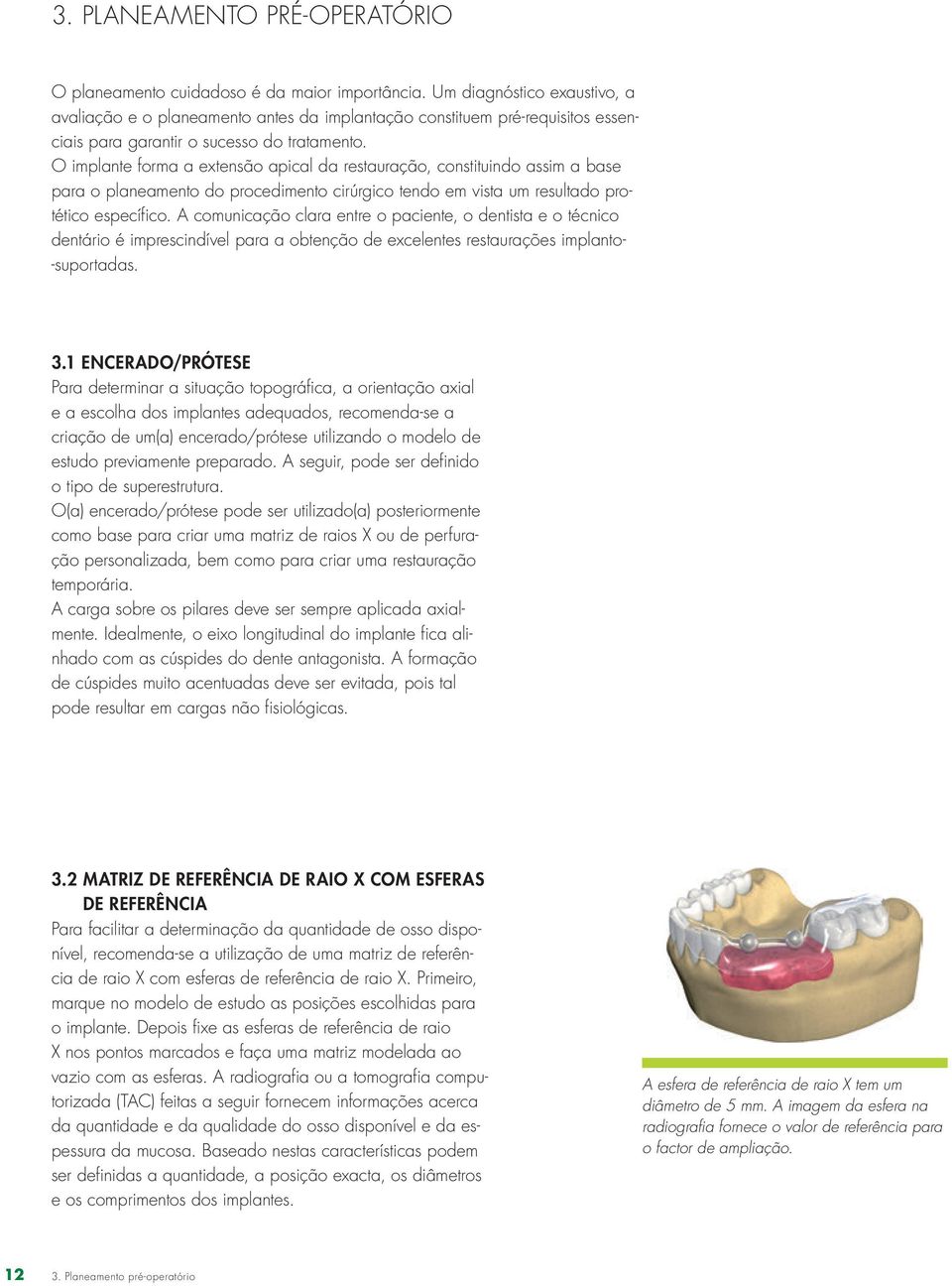 O implante forma a extensão apical da restauração, constituindo assim a base para o planeamento do procedimento cirúrgico tendo em vista um resultado protético específico.