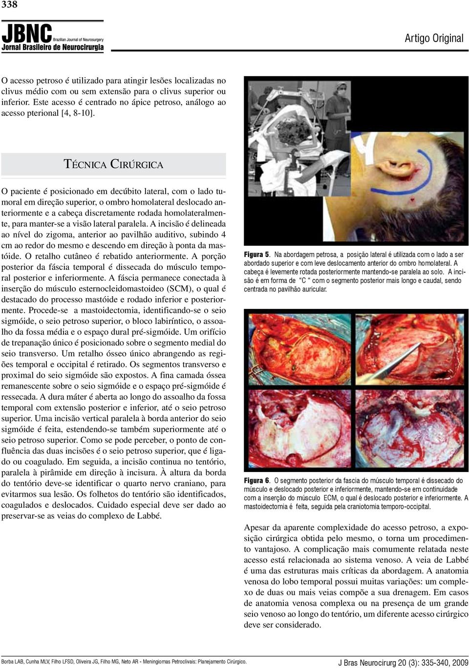 Técnica Cirúrgica O paciente é posicionado em decúbito lateral, com o lado tumoral em direção superior, o ombro homolateral deslocado anteriormente e a cabeça discretamente rodada homolateralmente,