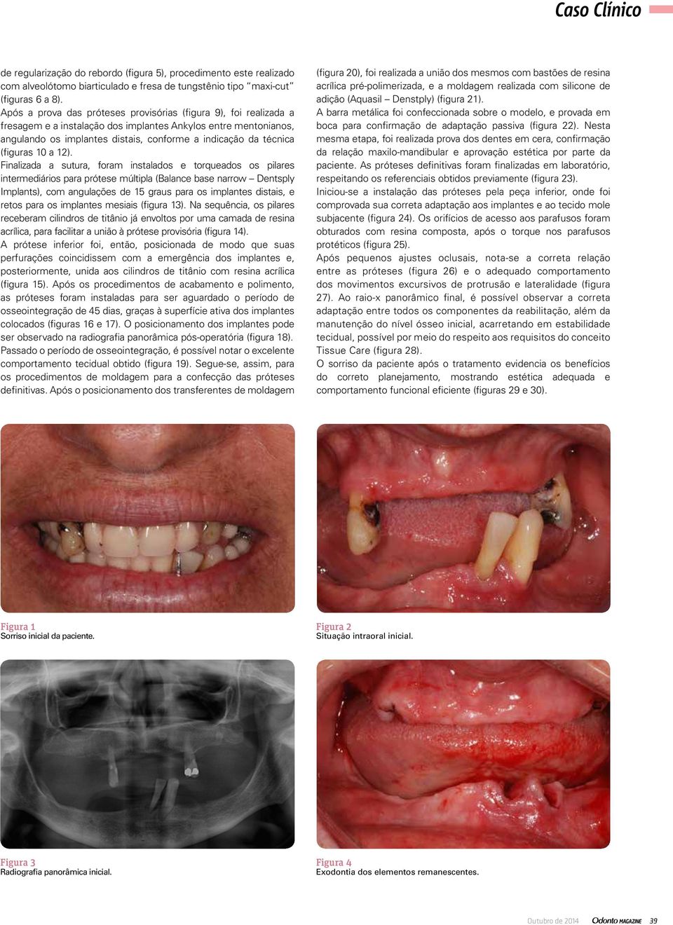 (figuras 10 a 12).