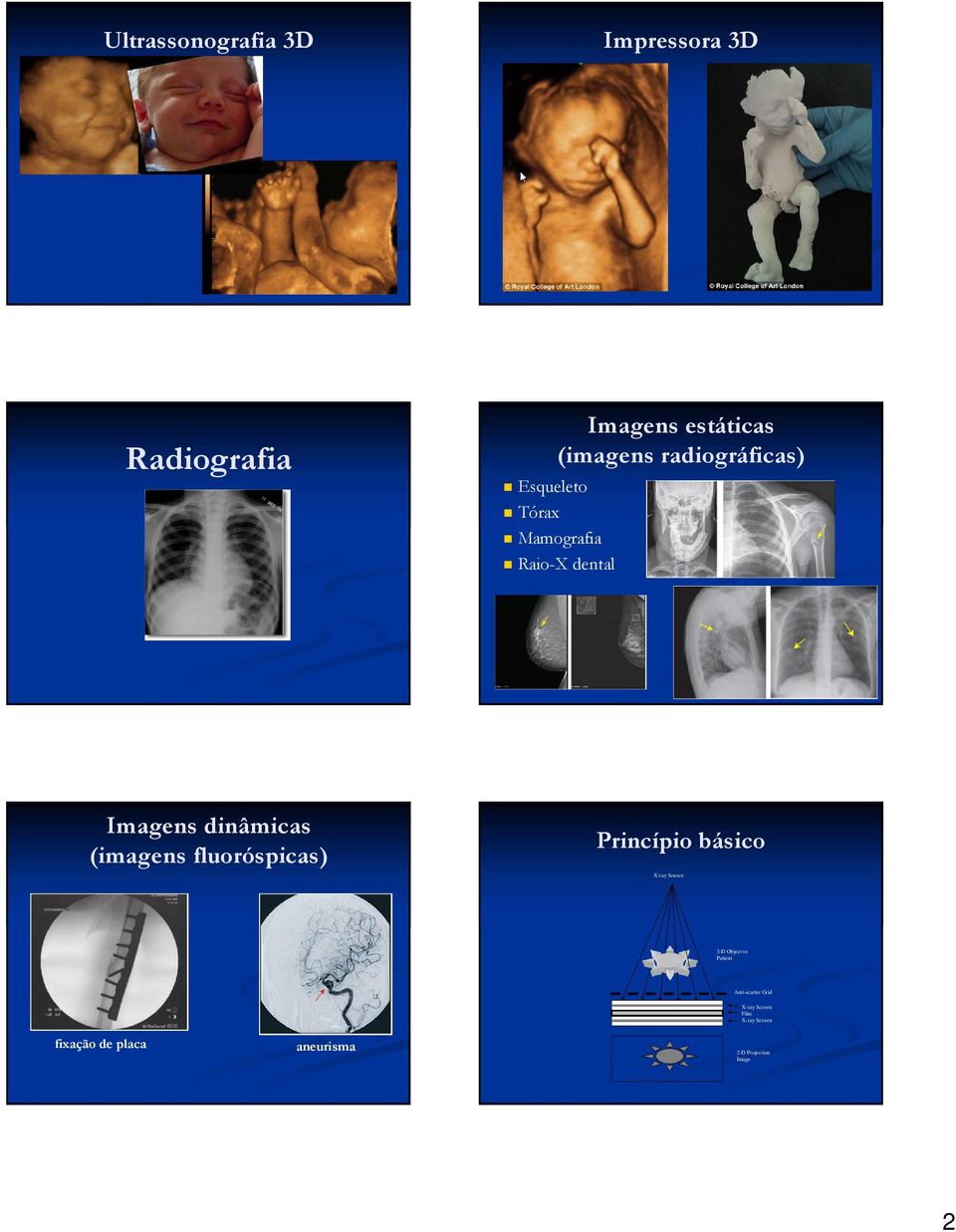 Mamografia Raio-X dental Princípio básico X-ray Source 3-D Object or Patient