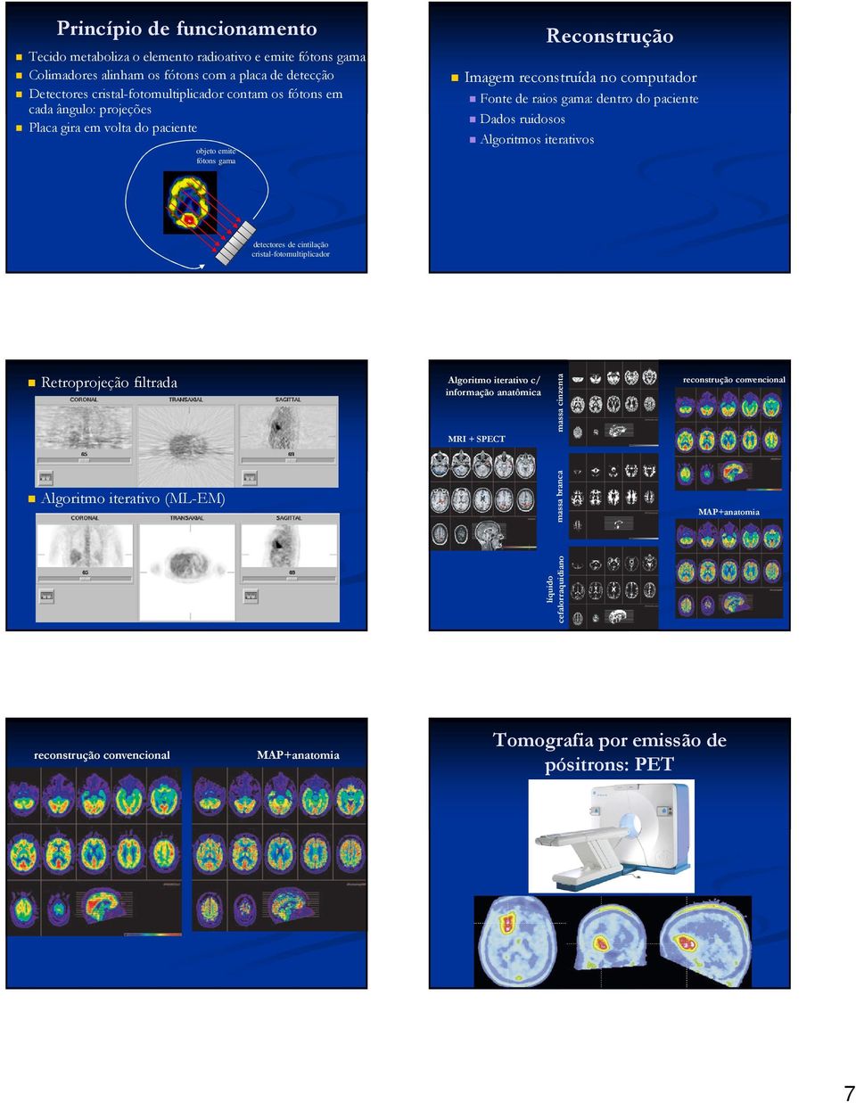 Tecido metaboliza o elemento radioativo e emite fótons gama Colimadores alinham os fótons com a placa de detecção Detectores cristal-fotomultiplicador contam os fótons em cada ângulo: