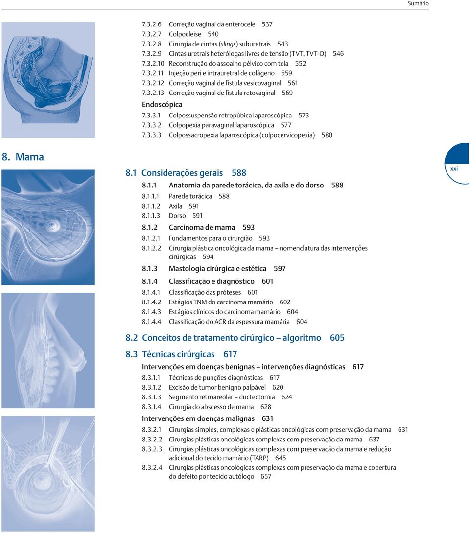 3.3.2 Colpopexia paravaginal laparoscópica 577 7.3.3.3 Colpossacropexia laparoscópica (colpocervicopexia) 580 8. Mama 8.1 Considerações gerais 588 8.1.1 Anatomia da parede torácica, da axila e do dorso 588 8.