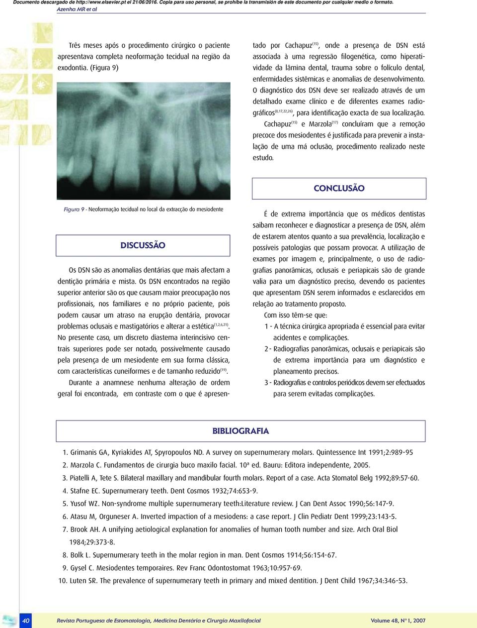 Os DSN encontrados na região superior anterior são os que causam maior preocupação nos profissionais, nos familiares e no próprio paciente, pois podem causar um atraso na erupção dentária, provocar