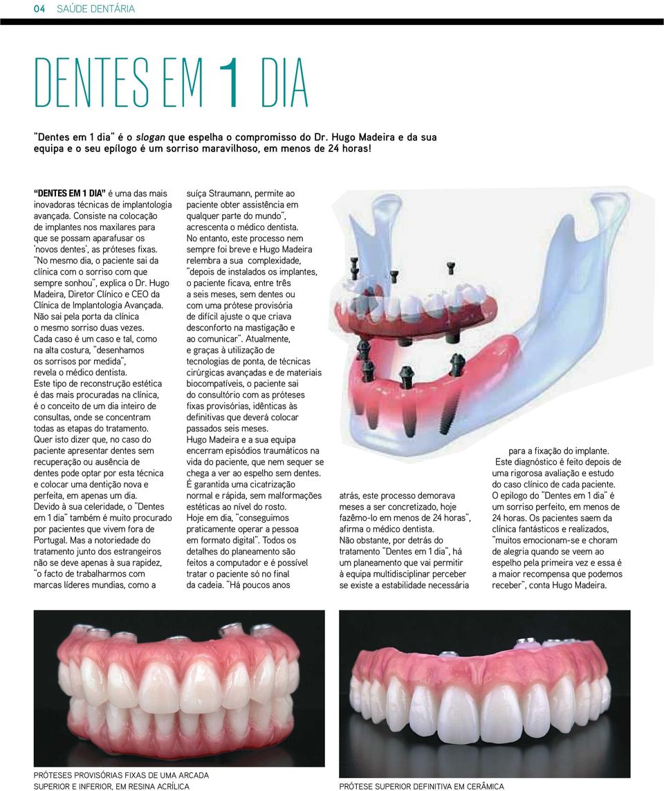 No mesmo dia, o paciente sai da clínica com o sorriso com que sempre sonhou, explica o Dr. Hugo Madeira, Diretor Clínico e CEO da Clínica de Implantologia Avançada.