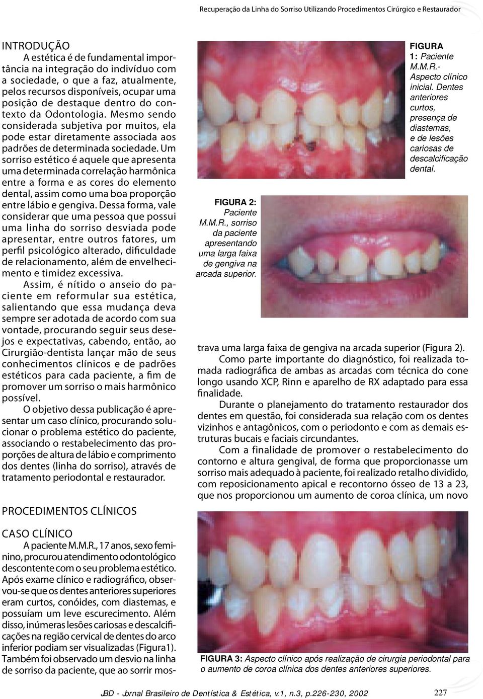 Um sorriso estético é aquele que apresenta uma determinada correlação harmônica entre a forma e as cores do elemento dental, assim como uma boa proporção entre lábio e gengiva.