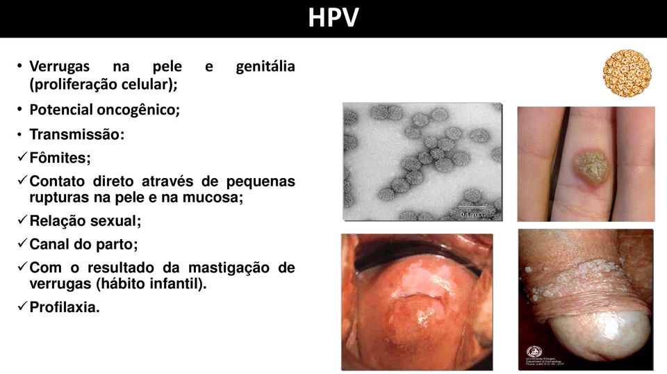 pequenas rupturas na pele e na mucosa; Relação sexual; Canal do