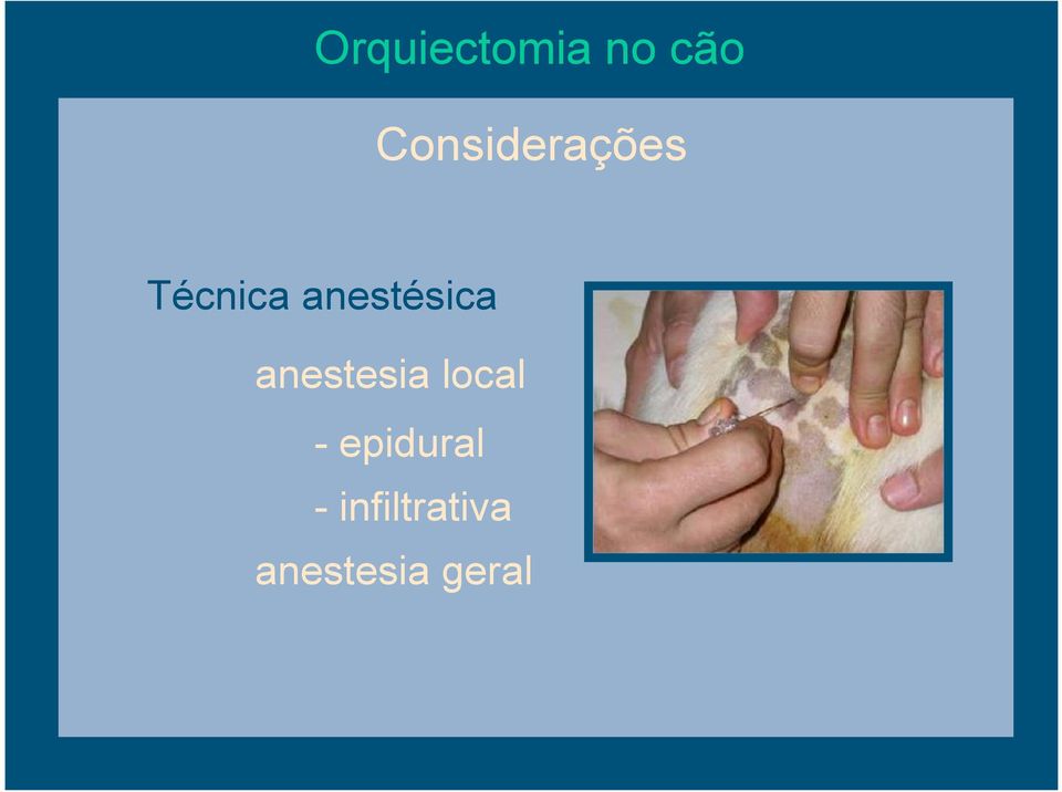 anestésica anestesia local