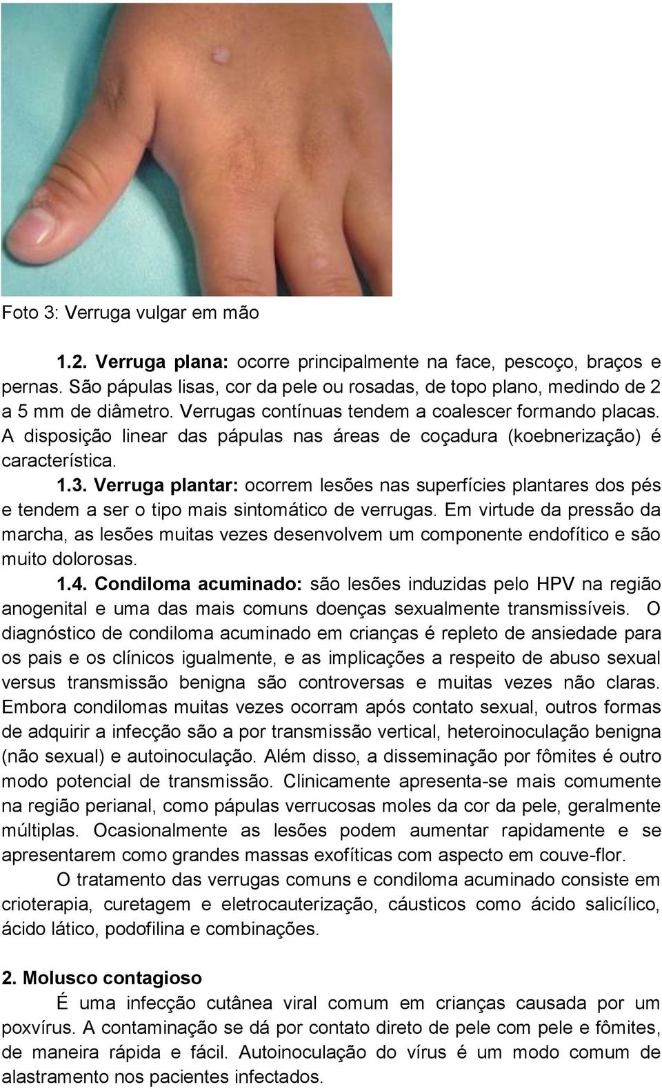 Verruga plantar: ocorrem lesões nas superfícies plantares dos pés e tendem a ser o tipo mais sintomático de verrugas.