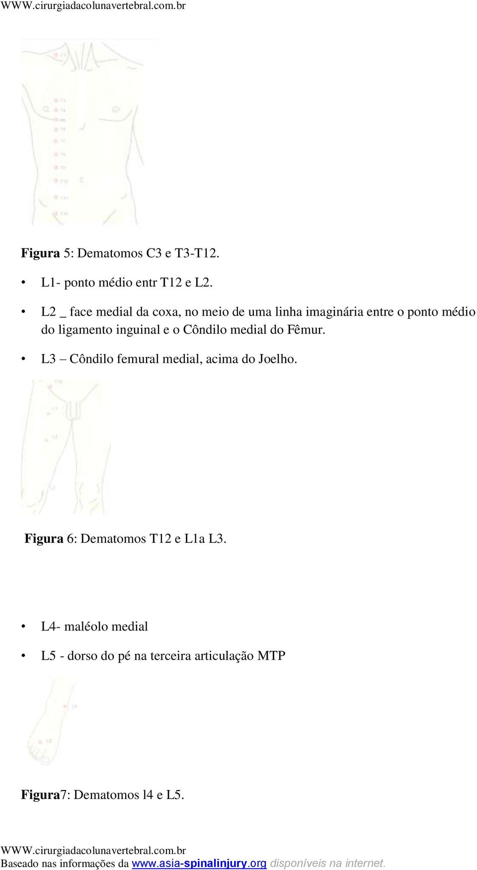 inguinal e o Côndilo medial do Fêmur. L3 Côndilo femural medial, acima do Joelho.