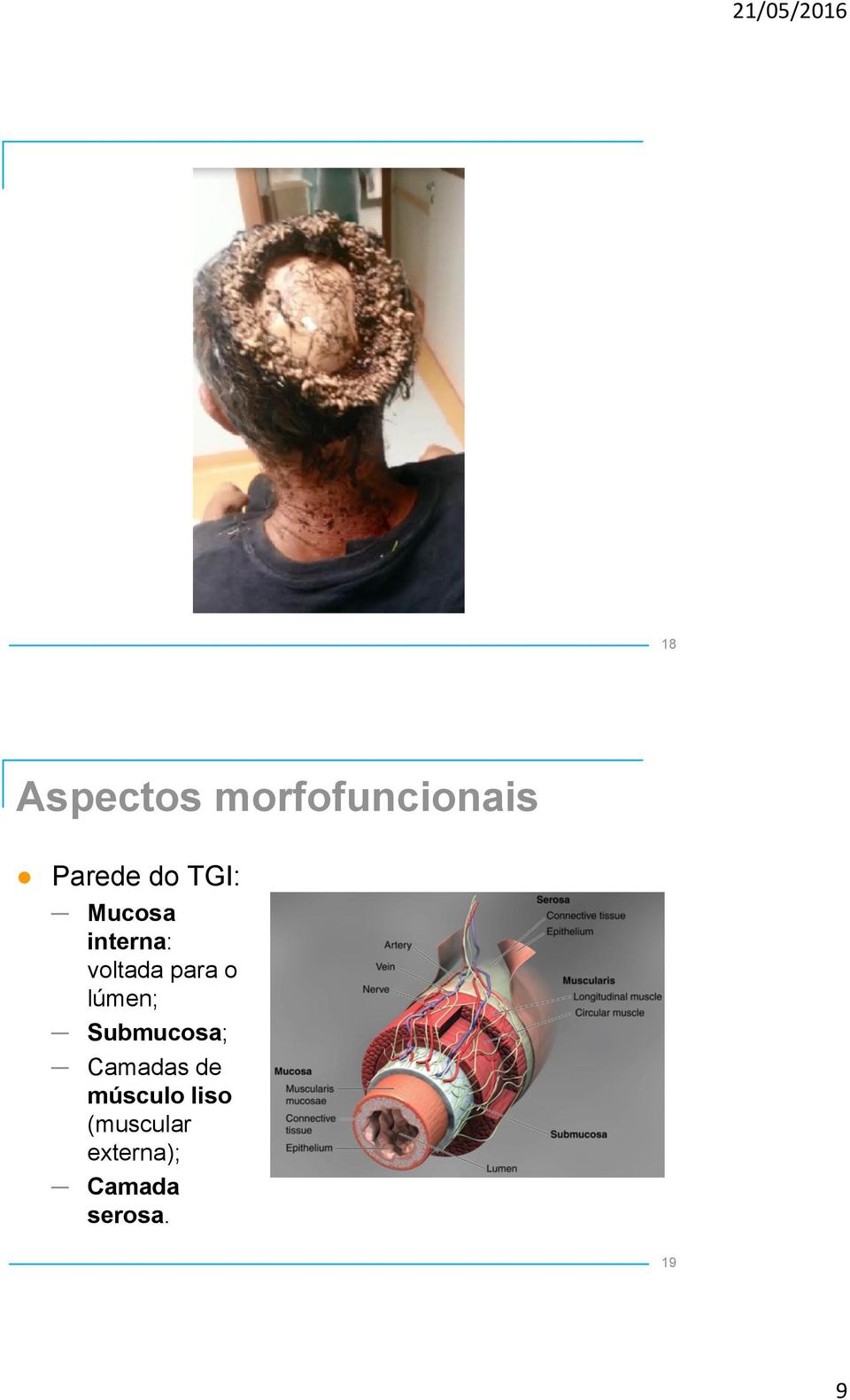 lúmen; Submucosa; Camadas de músculo