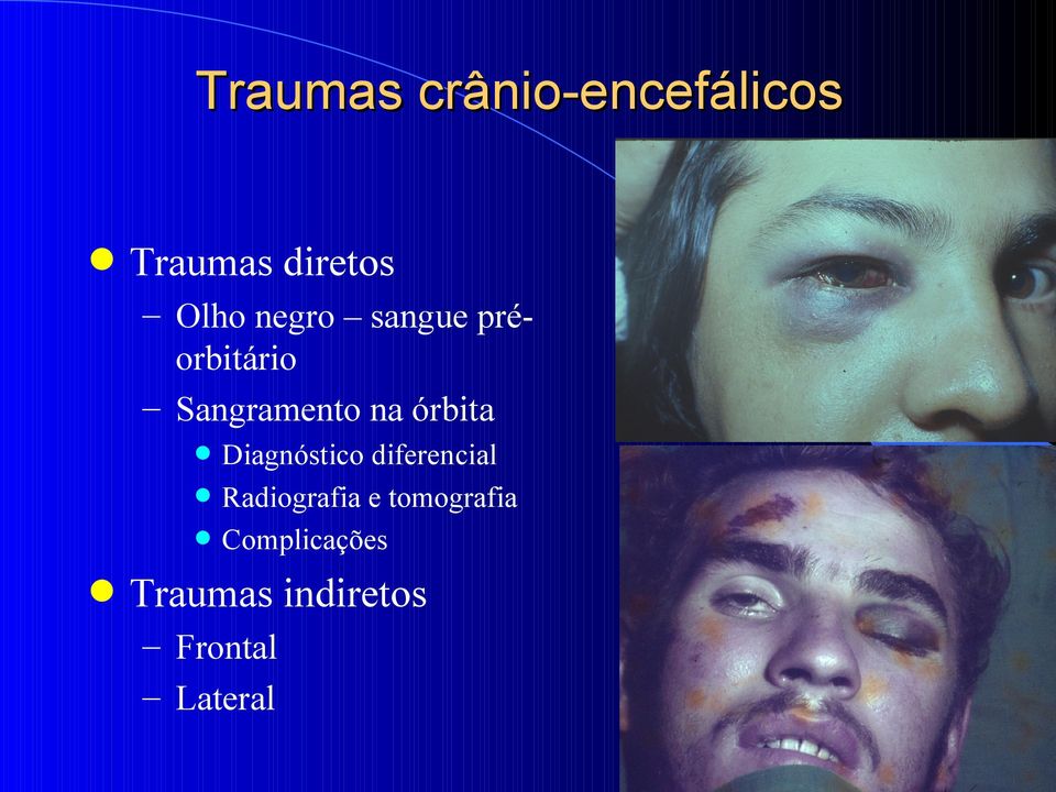 Diagnóstico diferencial Radiografia e