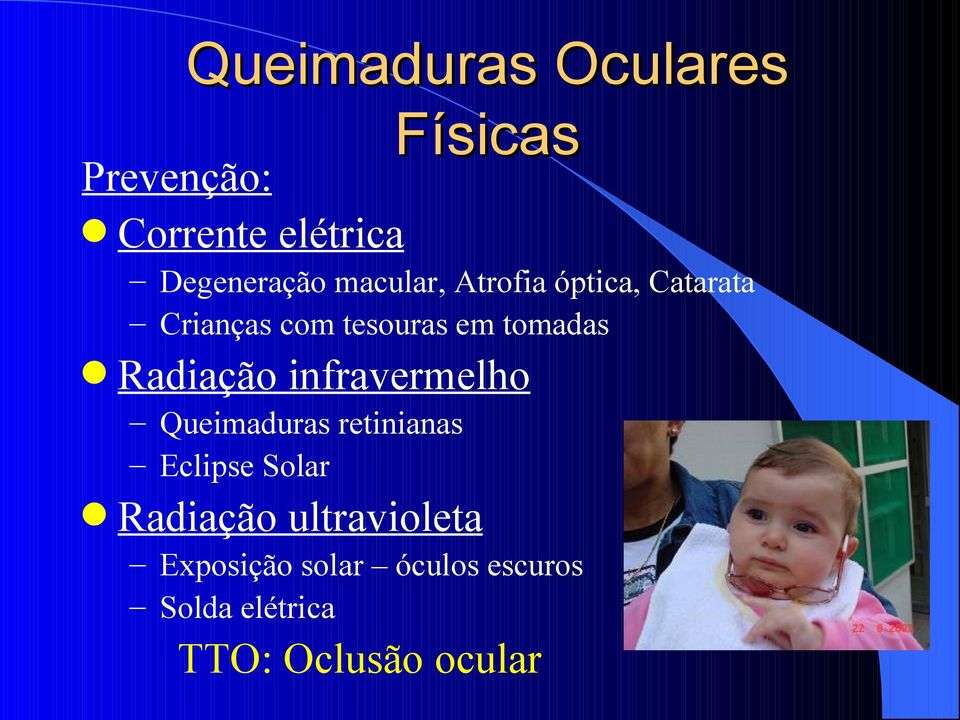 Radiação infravermelho Queimaduras retinianas Eclipse Solar Radiação