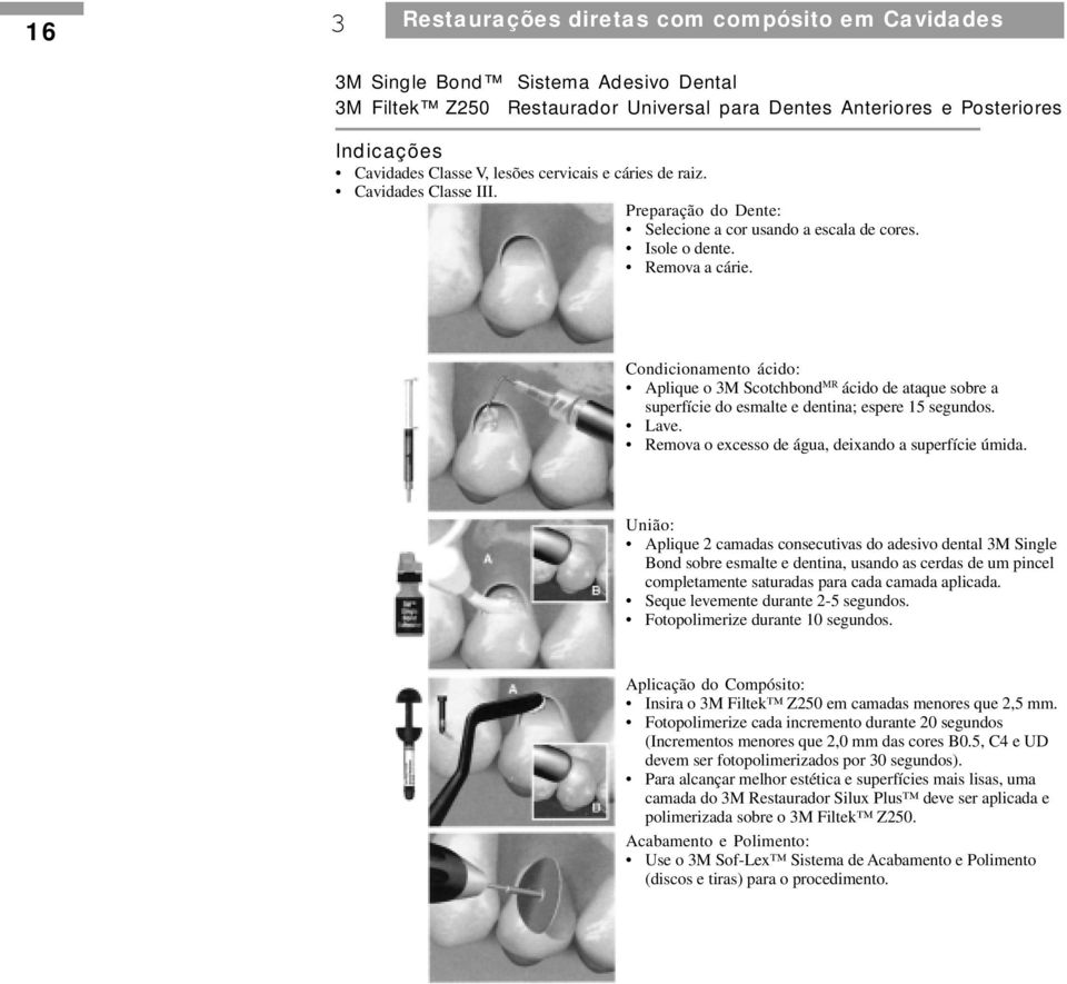 Condicionamento ácido: Aplique o 3M Scotchbond MR ácido de ataque sobre a superfície do esmalte e dentina; espere 15 segundos. Lave. Remova o excesso de água, deixando a superfície úmida.