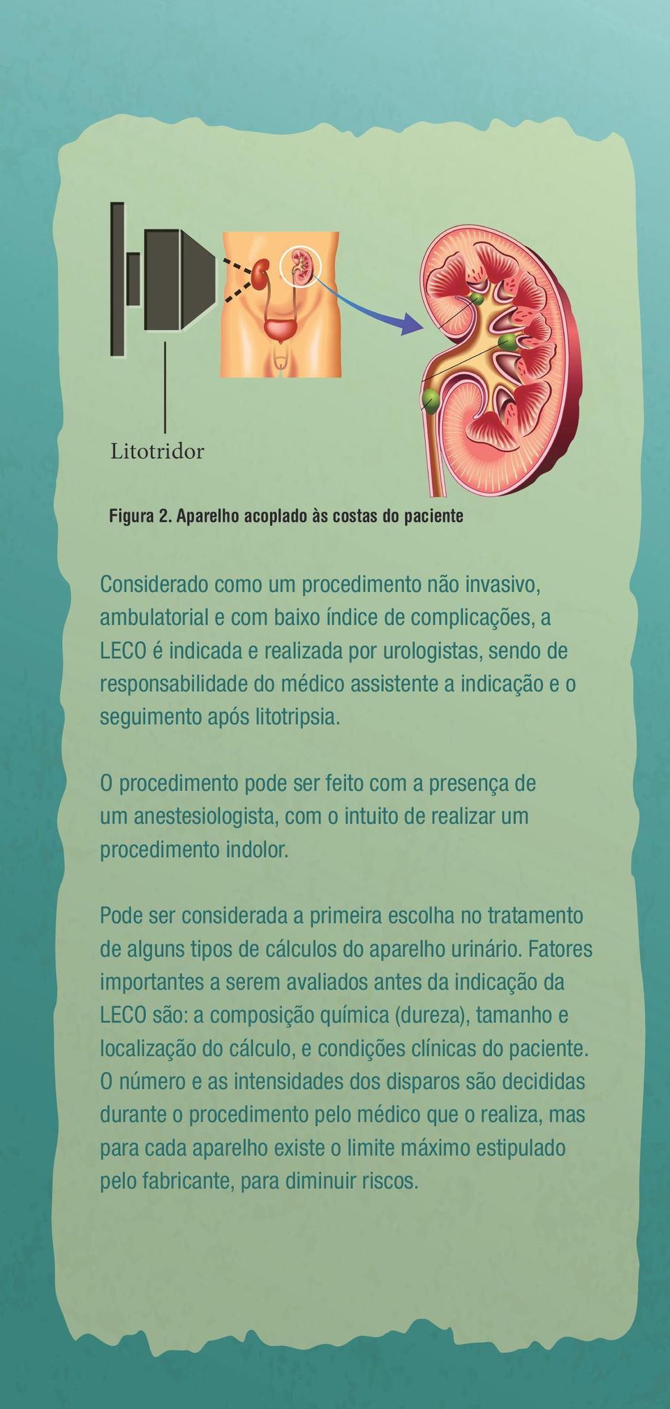 responsabilidade do médico assistente a indicação e o seguimento após litotripsia.