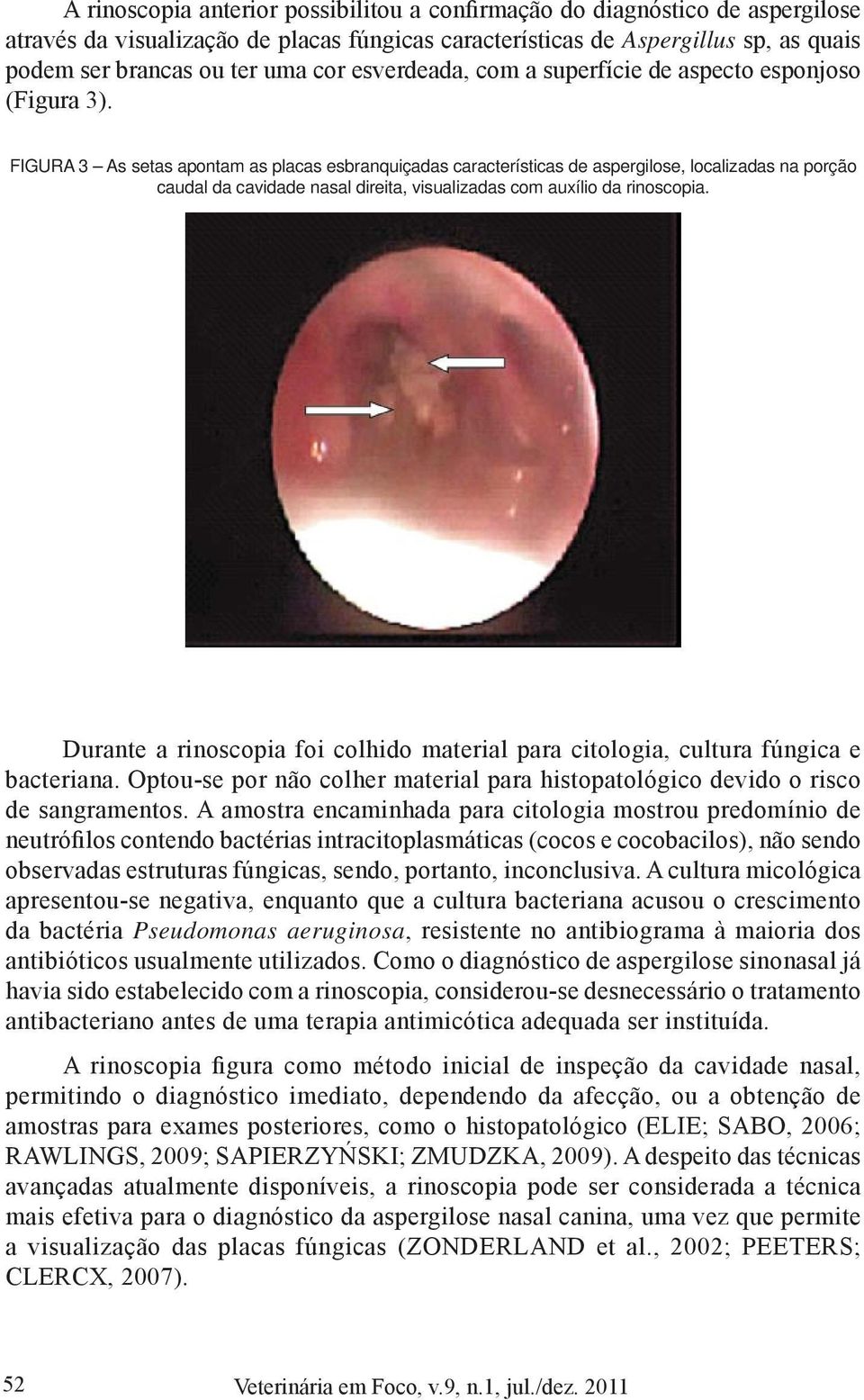 FIGURA 3 As setas apontam as placas esbranquiçadas características de aspergilose, localizadas na porção caudal da cavidade nasal direita, visualizadas com auxílio da rinoscopia.