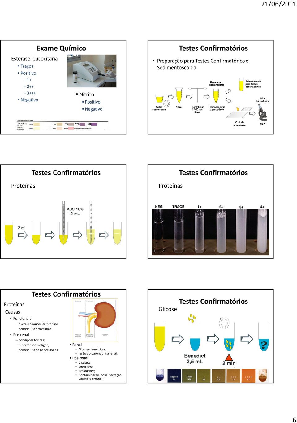 Pré-renal condições tóxicas; hipertensão maligna; proteinúriade Bence-Jones.