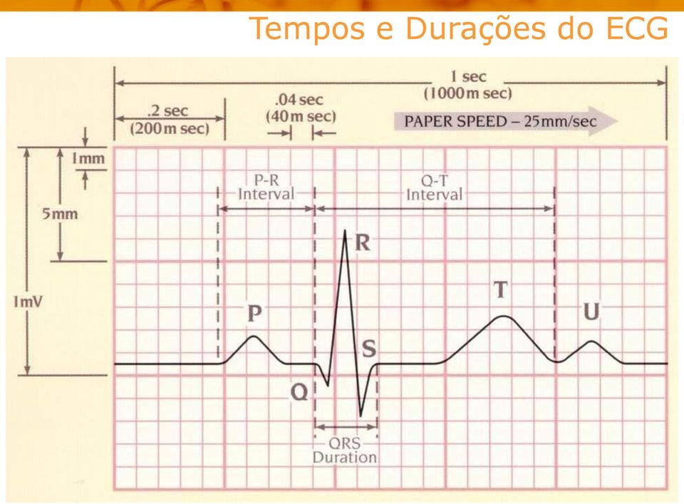 do ECG