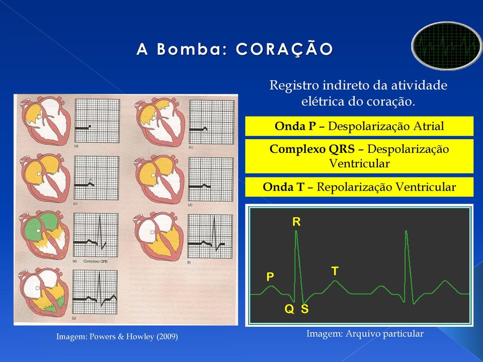 Onda P Despolarização Atrial Complexo QRS Despolarização