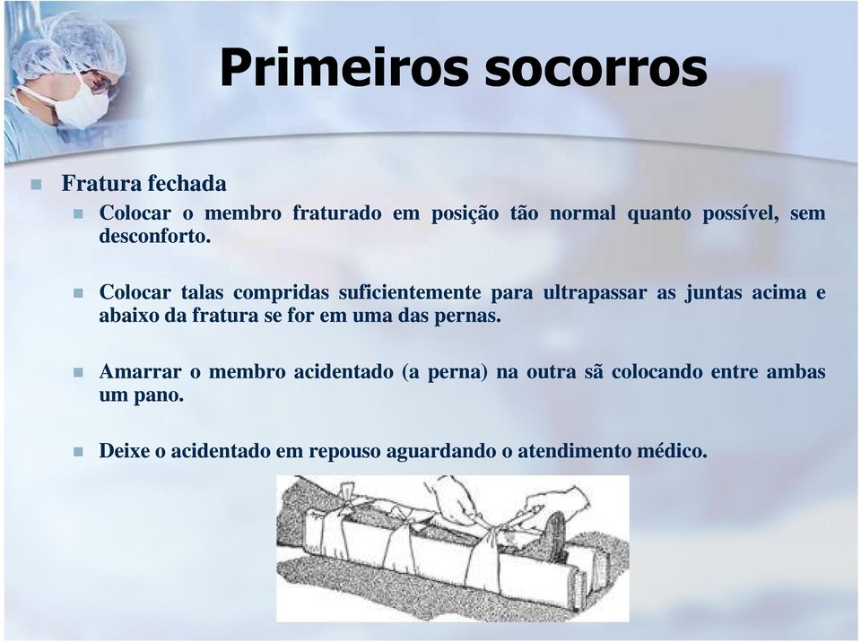 Colocar talas compridas suficientemente para ultrapassar as juntas acima e abaixo da fratura