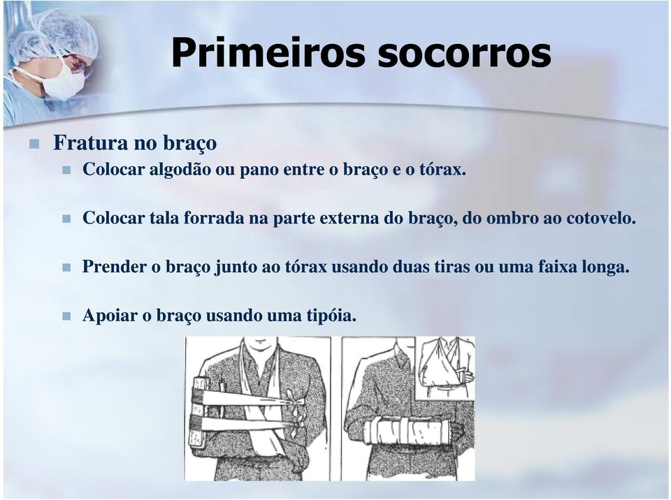 Colocar tala forrada na parte externa do braço, do ombro ao