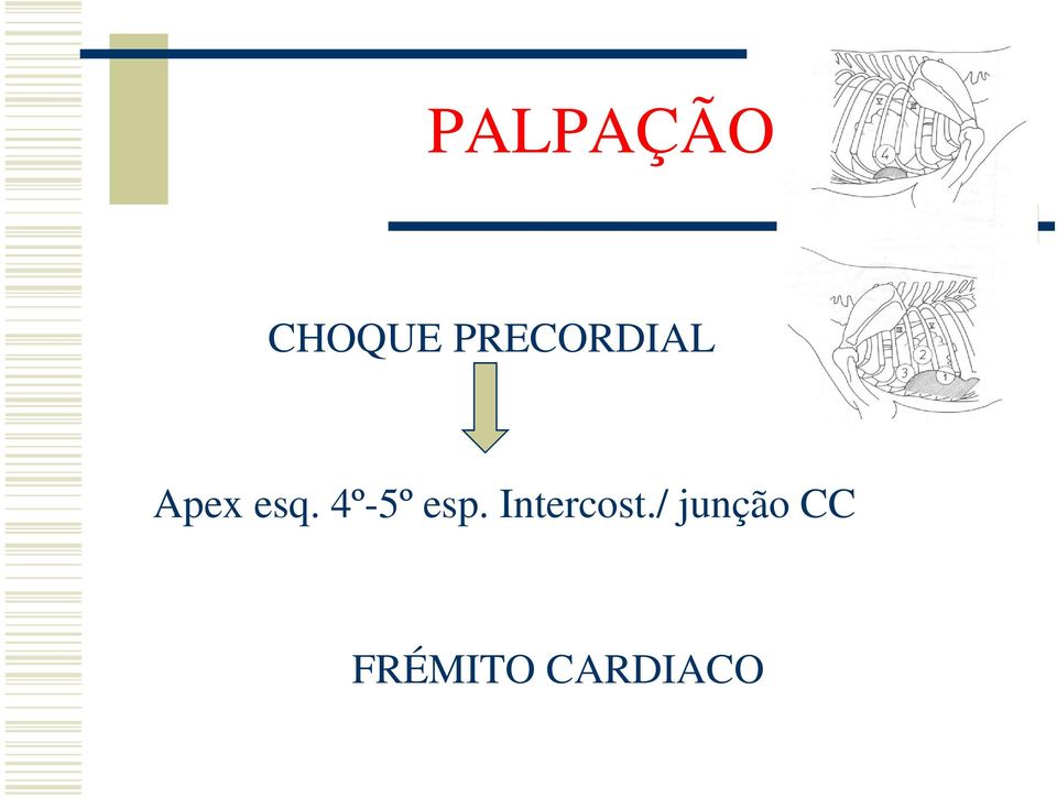 4º-5º esp. Intercost.