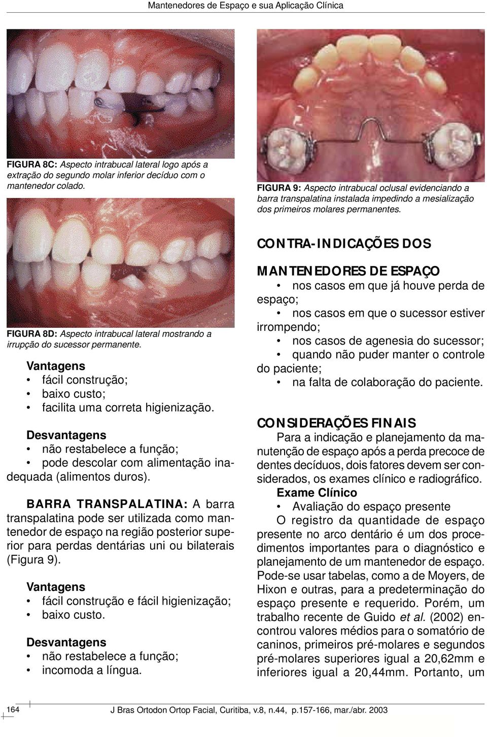 CONTRA-INDICAÇÕES DOS FIGURA 8D: Aspecto intrabucal lateral mostrando a irrupção do sucessor permanente. Vantagens fácil construção; baixo custo; facilita uma correta higienização.