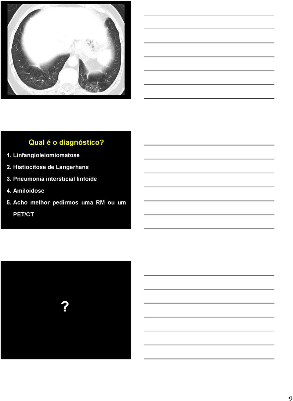 Histiocitose de Langerhans 3.