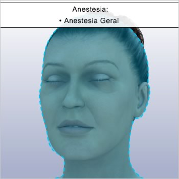 Como funciona o lifting facial do terço médio? Existem vários tipos de lifting facial, sendo que cada um corrige uma determinada área da face.