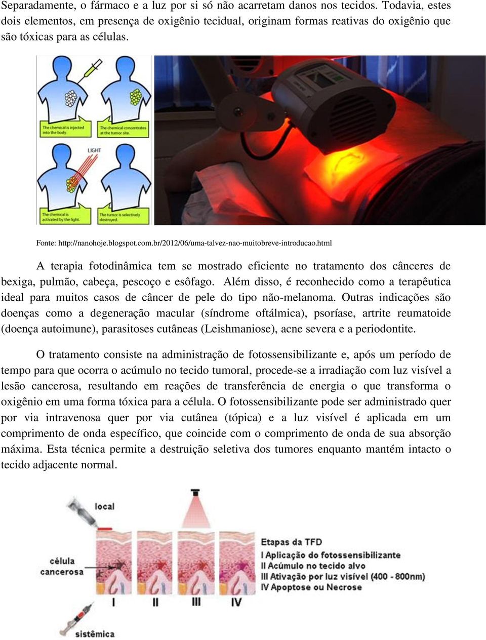 br/2012/06/uma-talvez-nao-muitobreve-introducao.html A terapia fotodinâmica tem se mostrado eficiente no tratamento dos cânceres de bexiga, pulmão, cabeça, pescoço e esôfago.