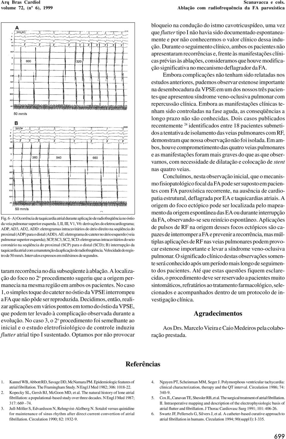 AE: eletrograma do cateter no átrio esquerdo (veia pulmonar superior esquerda); SCP, SC3, SC2, SCD: eletrogramas intracavitários do seio coronário na seqüência do proximal (SCP) para o distal (SCD);