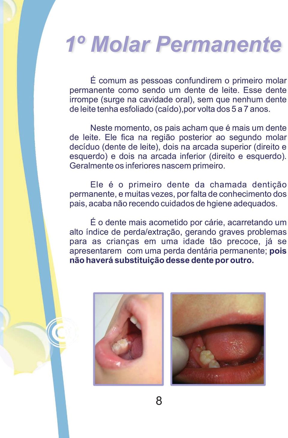 Ele fica na região posterior ao segundo molar decíduo (dente de leite), dois na arcada superior (direito e esquerdo) e dois na arcada inferior (direito e esquerdo).