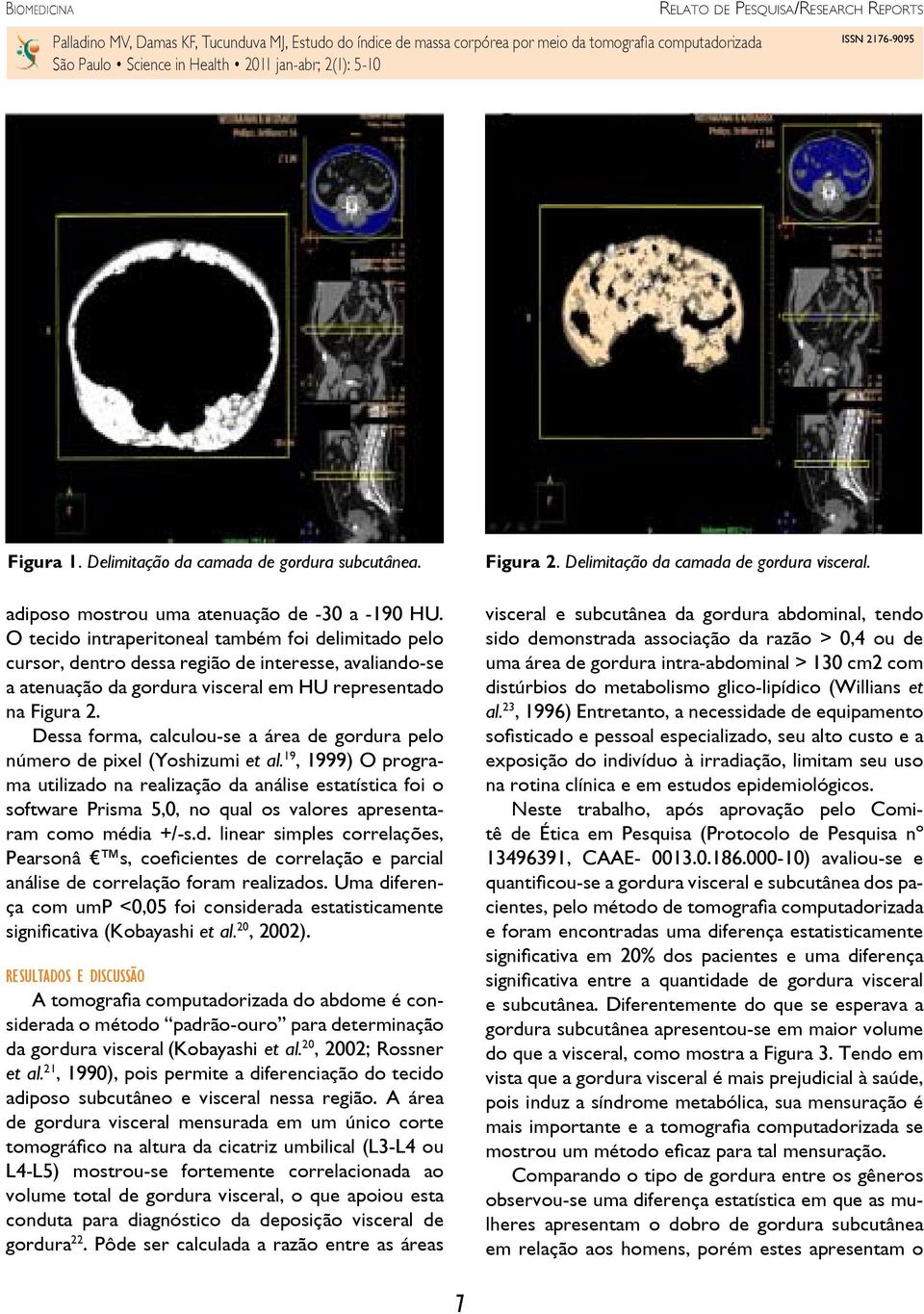 Dessa forma, calculou-se a área de gordura pelo número de pixel (Yoshizumi et al.