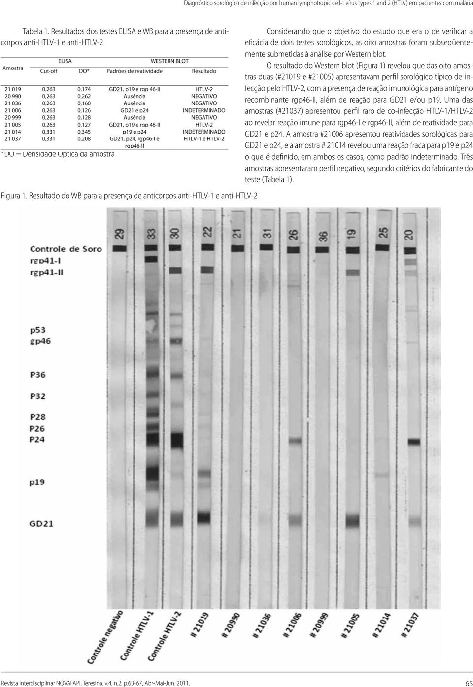 Resultado do WB para a presença de anticorpos anti-htlv-1 e anti-htlv-2 Considerando que o objetivo do estudo que era o de verificar a eficácia de dois testes sorológicos, as oito amostras foram