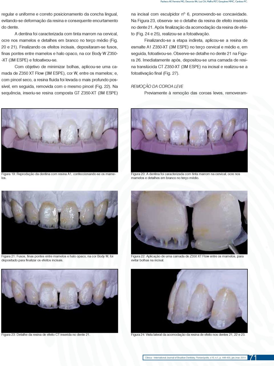 A dentina foi caracterizada com tinta marrom na cervical, ocre nos mamelos e detalhes em branco no terço médio (Fig. 20 e 21).