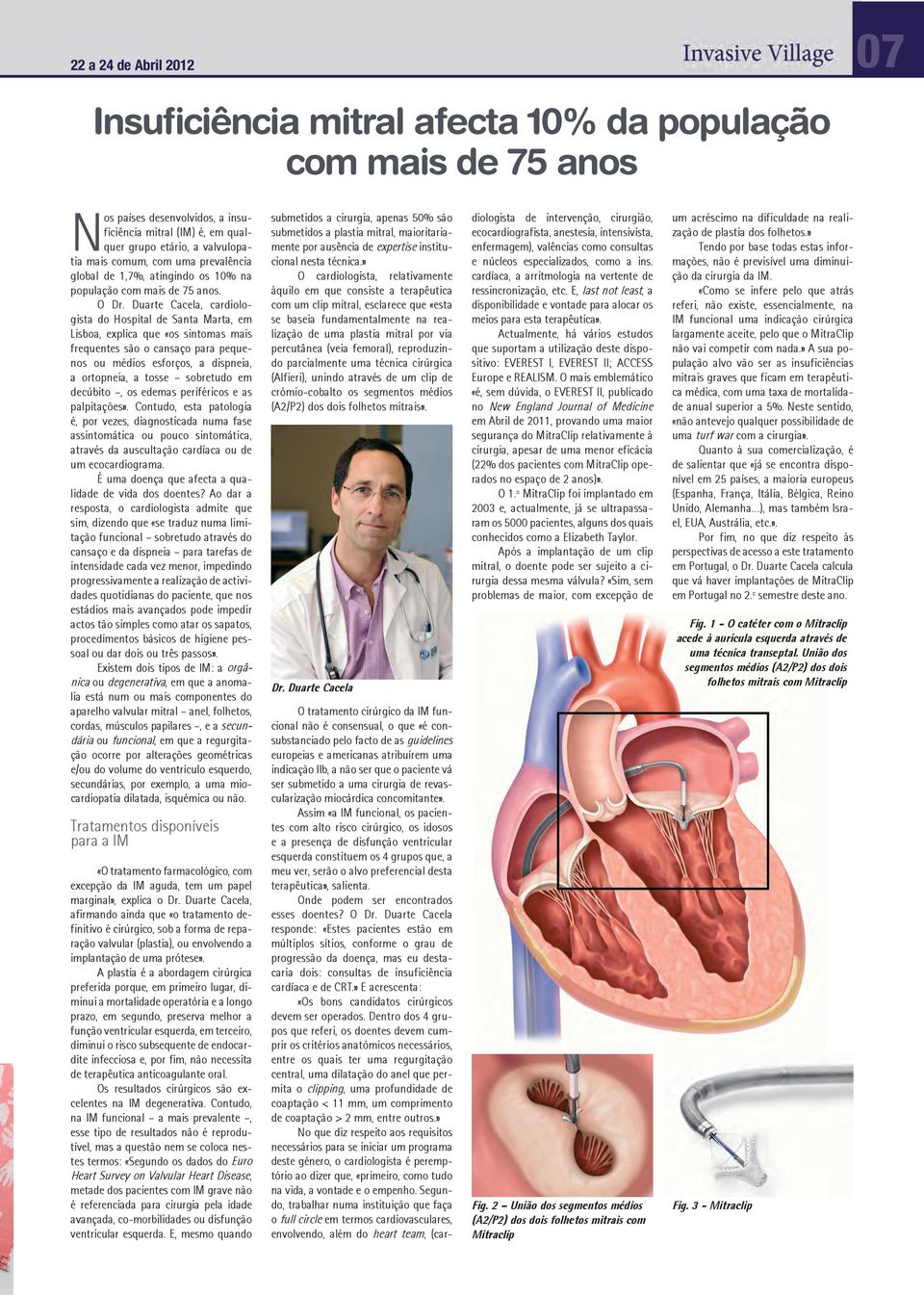 Duarte Cacela, cardiologista do Hospital de Santa Marta, em Lisboa, explica que «os sintomas mais frequentes são o cansaço para pequenos ou médios esforços, a dispneia, a ortopneia, a tosse sobretudo