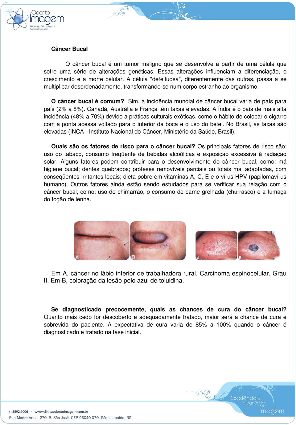 A célula "defeituosa", diferentemente das outras, passa a se multiplicar desordenadamente, transformando-se num corpo estranho ao organismo. O câncer bucal é comum?