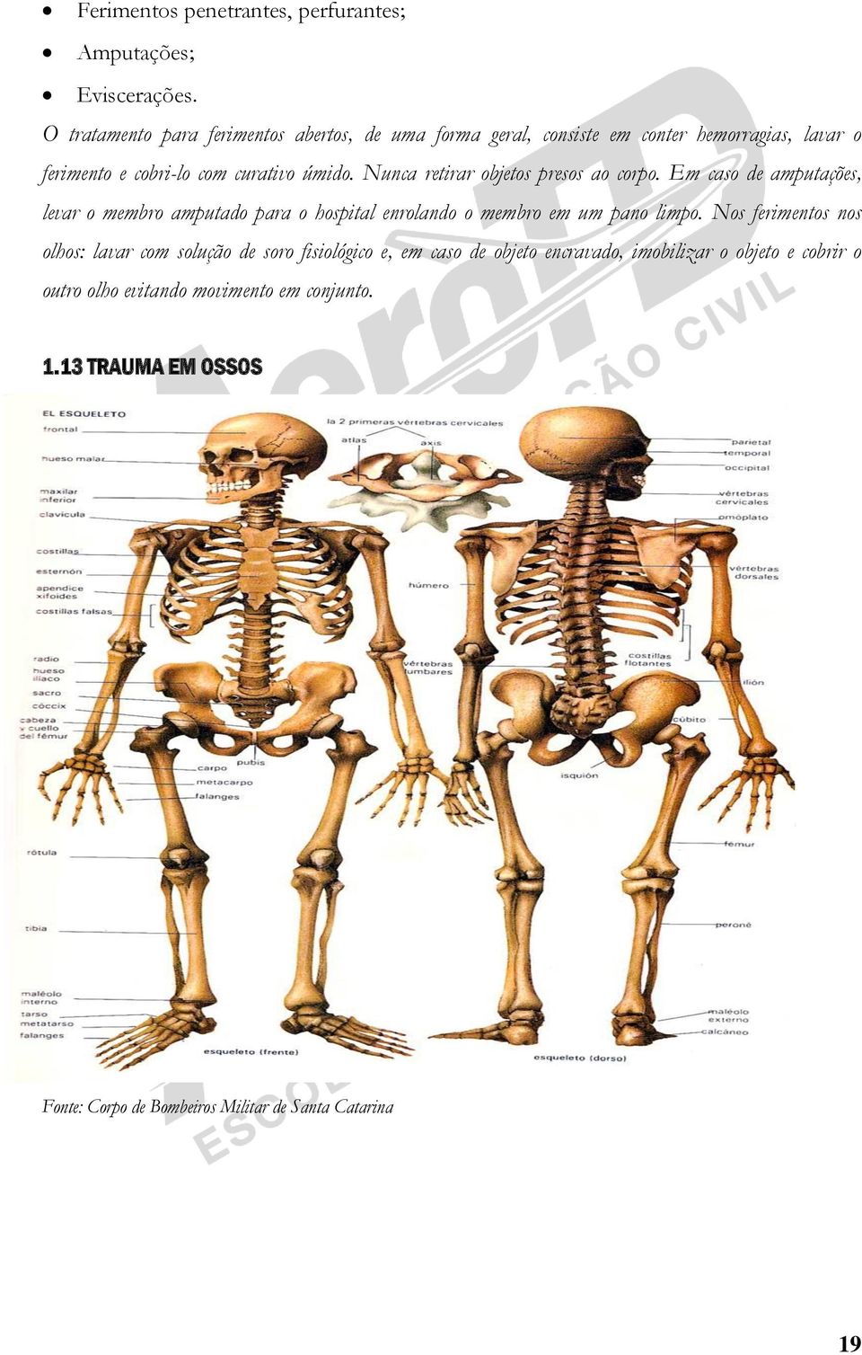 Nunca retirar objetos presos ao corpo. Em caso de amputações, levar o membro amputado para o hospital enrolando o membro em um pano limpo.