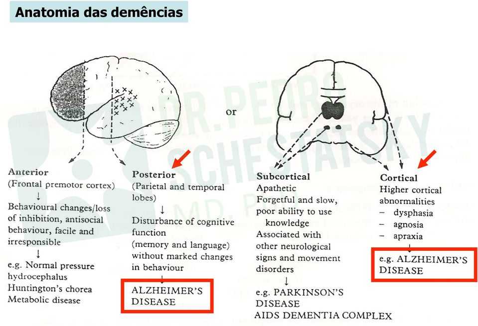 demências