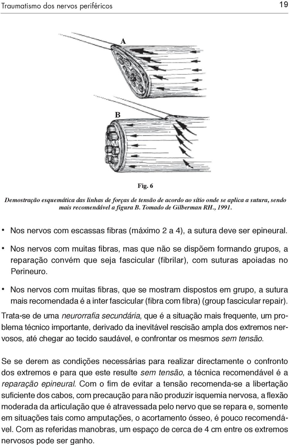 Nos nervos com muitas fibras, mas que não se dispõem formando grupos, a reparação convém que seja fascicular (fibrilar), com suturas apoiadas no Perineuro.