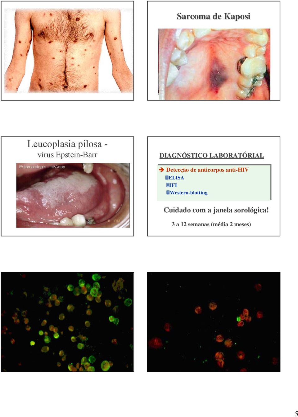 de anticorpos anti-hiv ELISA IFI Western-blotting