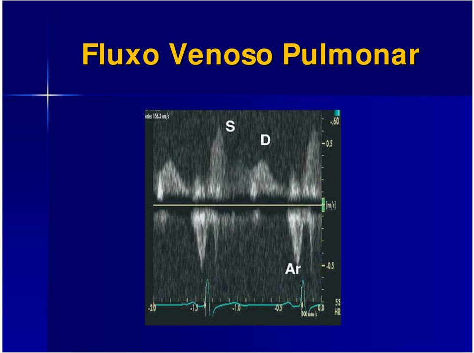 Pulmonar