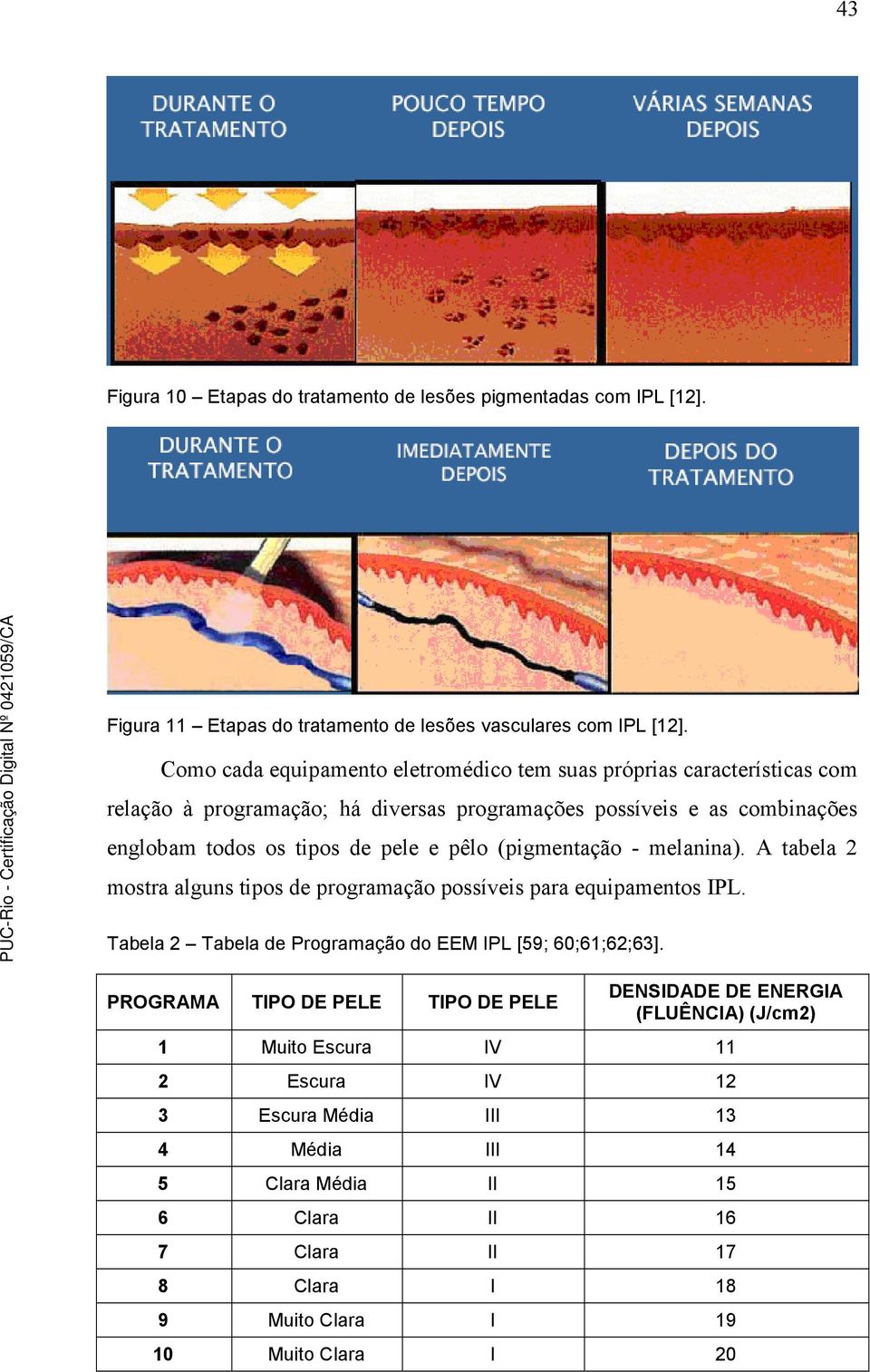 pêlo (pigmentação - melanina). A tabela 2 mostra alguns tipos de programação possíveis para equipamentos IPL. Tabela 2 Tabela de Programação do EEM IPL [59; 60;61;62;63].