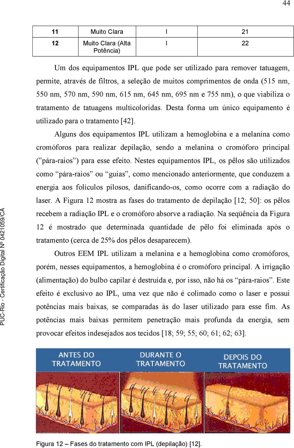 Alguns dos equipamentos IPL utilizam a hemoglobina e a melanina como cromóforos para realizar depilação, sendo a melanina o cromóforo principal ( pára-raios ) para esse efeito.