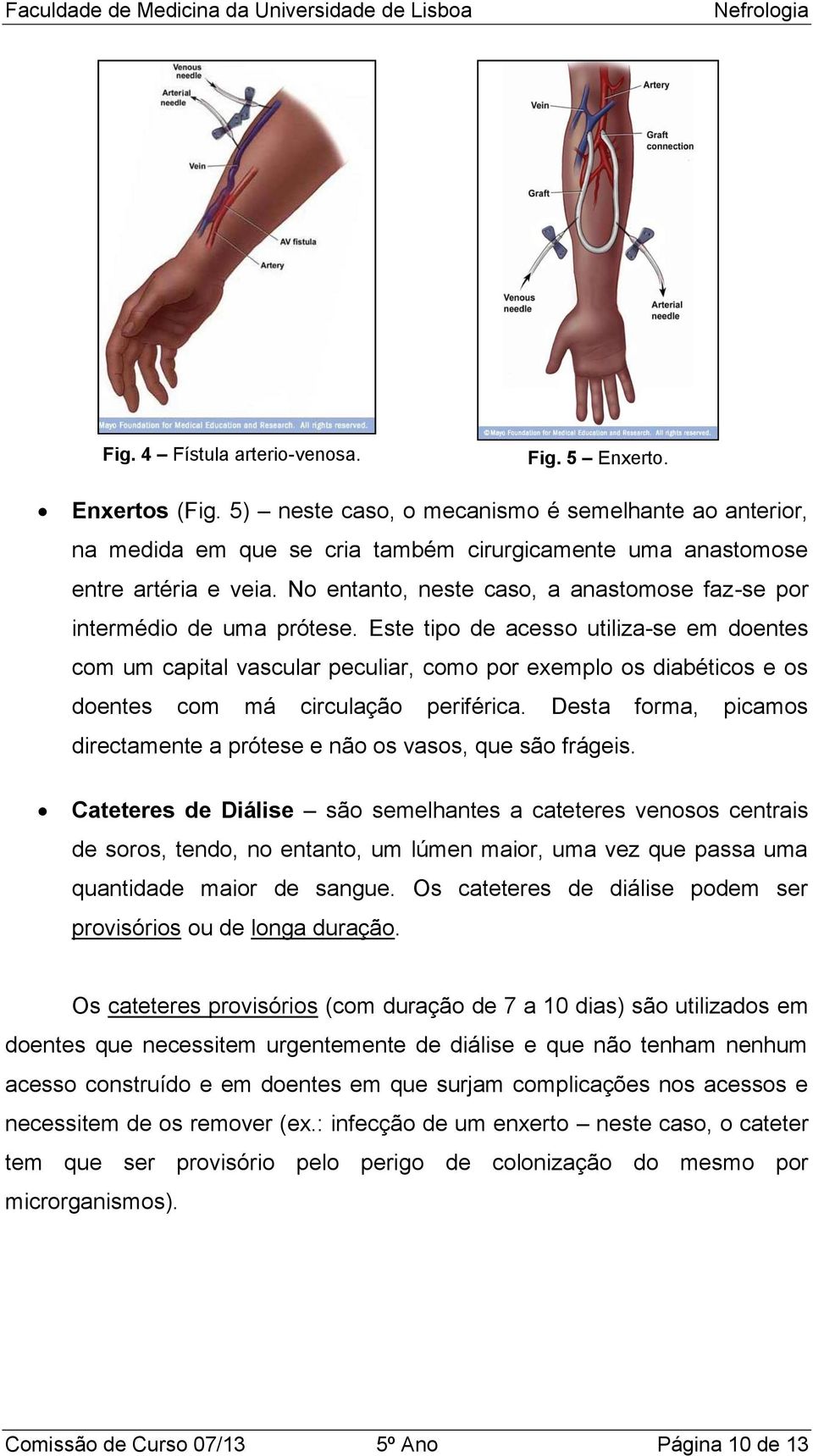 No entanto, neste caso, a anastomose faz-se por intermédio de uma prótese.