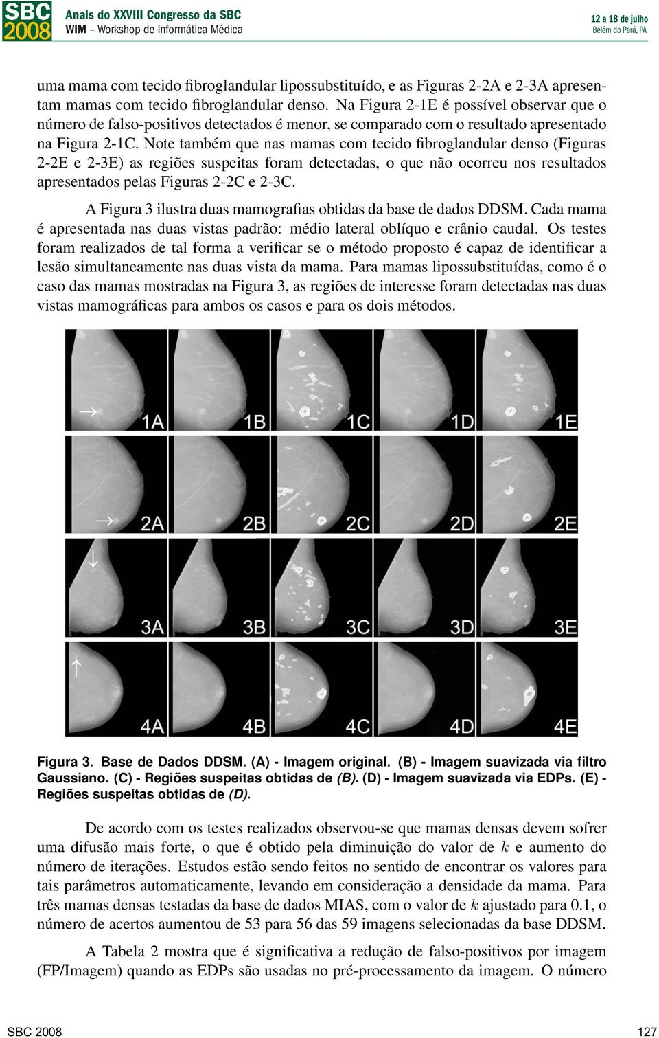 Note também que nas mamas com tecido fibroglandular denso (Figuras 2-2E e 2-3E) as regiões suspeitas foram detectadas, o que não ocorreu nos resultados apresentados pelas Figuras 2-2C e 2-3C.